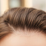 Close-up da linha do cabelo e da testa de uma pessoa com pele clara e cabelo castanho liso, mostrando o padrão de crescimento natural e a textura. O plano de fundo está desfocado.
