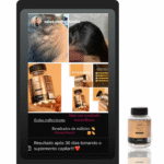 Uma colagem apresenta fotos de antes e depois do couro cabeludo de uma mulher, um frasco com o rótulo Lizzon Plus Caps, um texto destacando os resultados de 30 dias e uma imagem separada do frasco do suplemento.