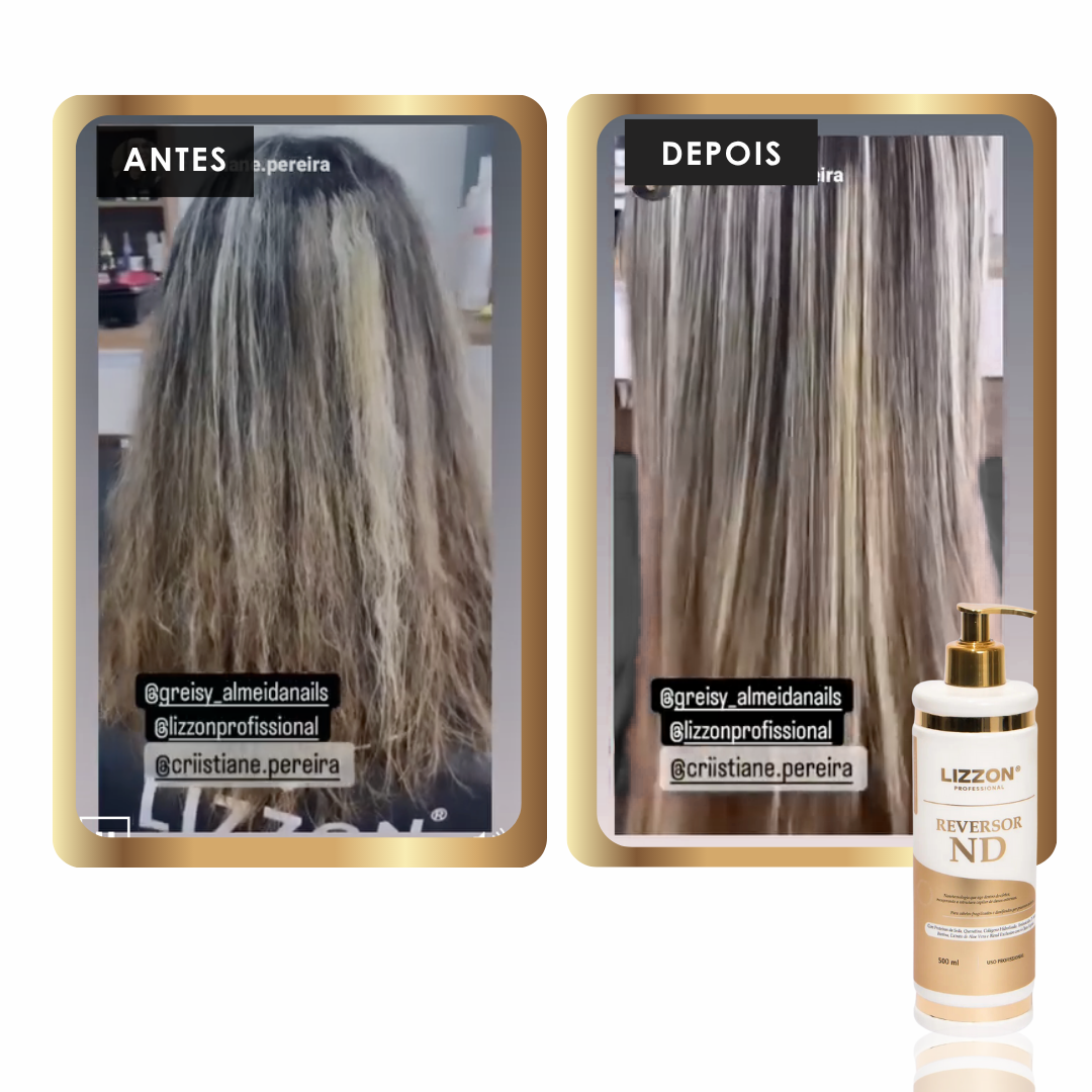 Fotos lado a lado mostram a parte de trás da cabeça de uma pessoa antes e depois de um tratamento com o Reversor de Danos - ND.