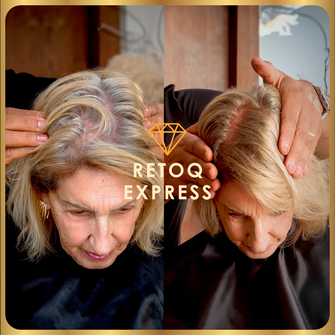 Comparação lado a lado do couro cabeludo e da linha do cabelo de uma mulher idosa antes e depois de um tratamento capilar, com as mãos separando o cabelo para mostrar os resultados. O texto RETOQ EXPRESS está sobreposto no centro.