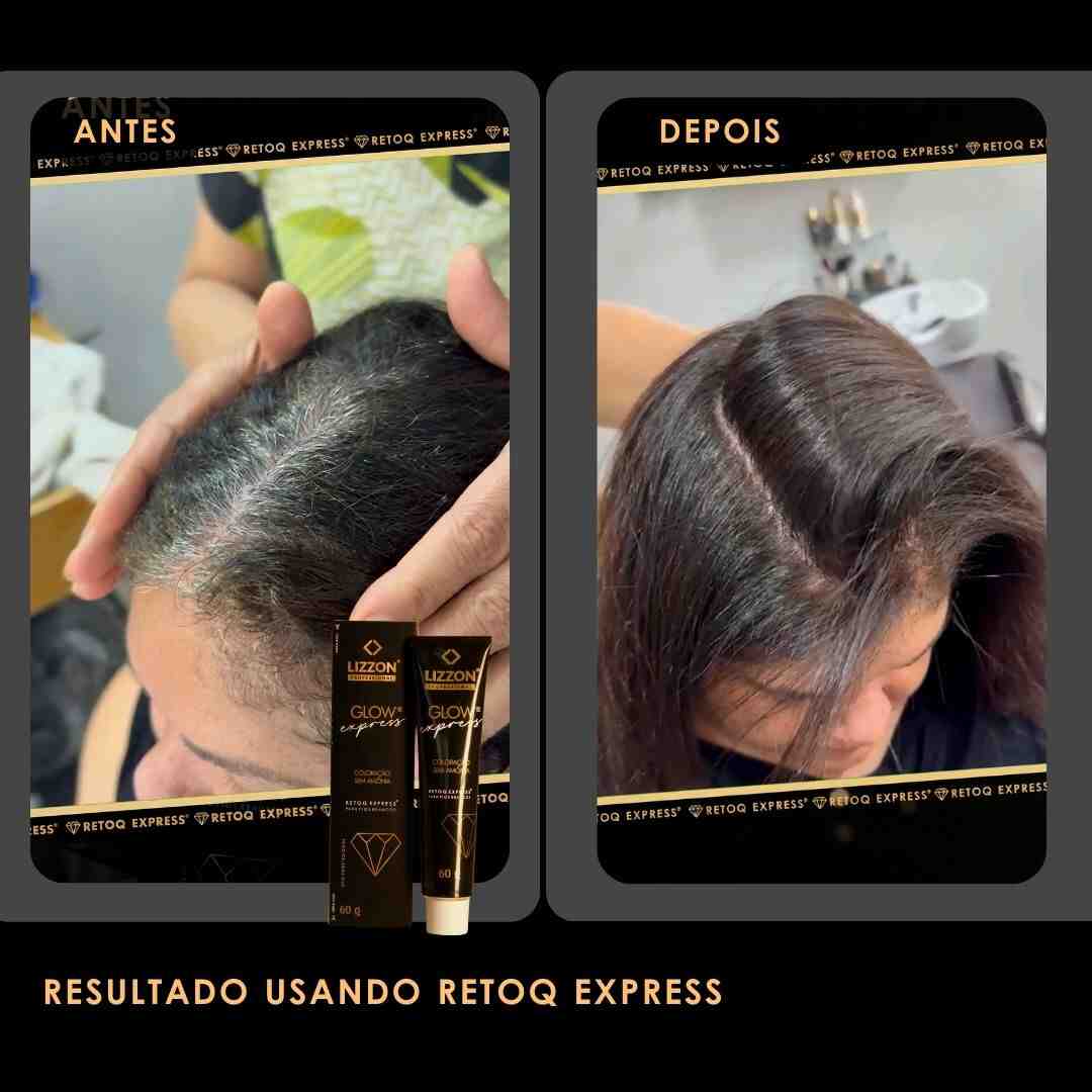 A comparação lado a lado mostra o cabelo antes (mais fino, couro cabeludo visível) e depois (cabelo mais cheio, mais escuro) usando o kit Retoq Express Home (Tons escuros). As etiquetas dizem "Antes" e "Depois". Os tubos do produto são mostrados no canto inferior esquerdo.