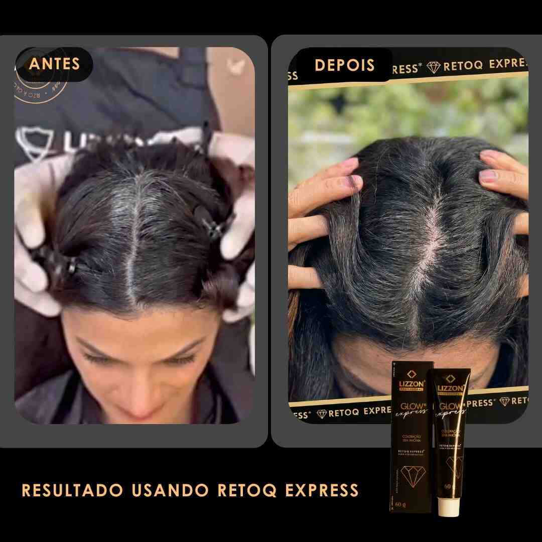 Comparação lado a lado do couro cabeludo de uma mulher antes e depois de usar o kit Retoq Express Home (Tons escuros): o lado esquerdo mostra raízes grisalhas visíveis, enquanto o lado direito apresenta cabelos mais escuros e uniformemente coloridos.